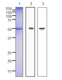 RAD51 | DNA repair protein RAD51 (Saccharomyces cerevisiae) (ChIP grade) in the group Antibodies Other Species / Fungi at Agrisera AB (Antibodies for research) (AS21 4549)